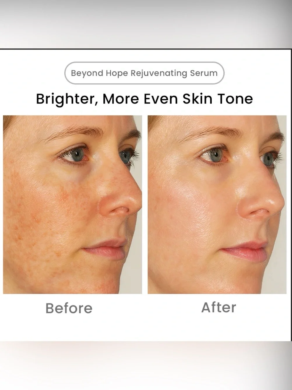 Blaq Beyond Hope Rejuvenating Serum, 10mL / 0.34 fl oz.